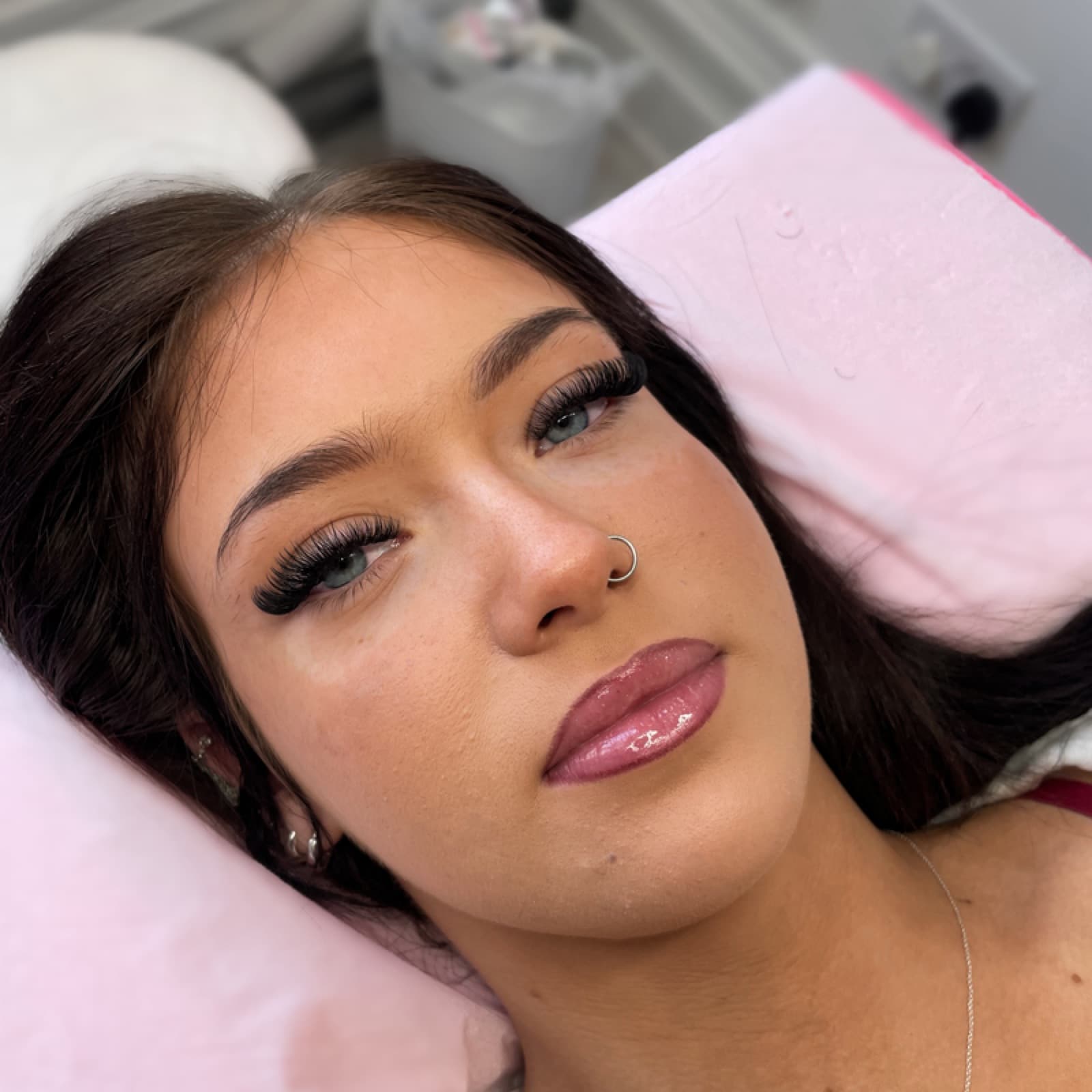Dermaplaning Facial result 2 at K Beauty Wallsend, Newcastle